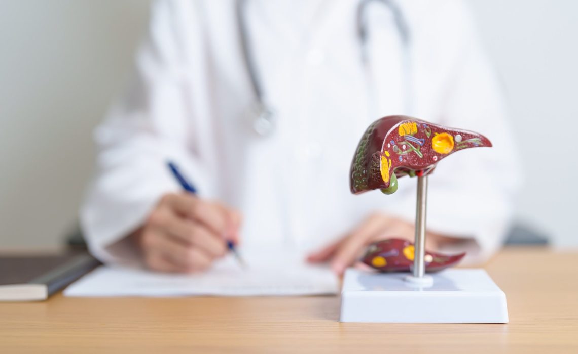 Doctor with human Liver anatomy model. Liver cancer and Tumor, Jaundice, Viral Hepatitis A, B, C, D, E, Cirrhosis, Failure, Enlarged, Hepatic Encephalopathy, Ascites Fluid in Belly and health concept