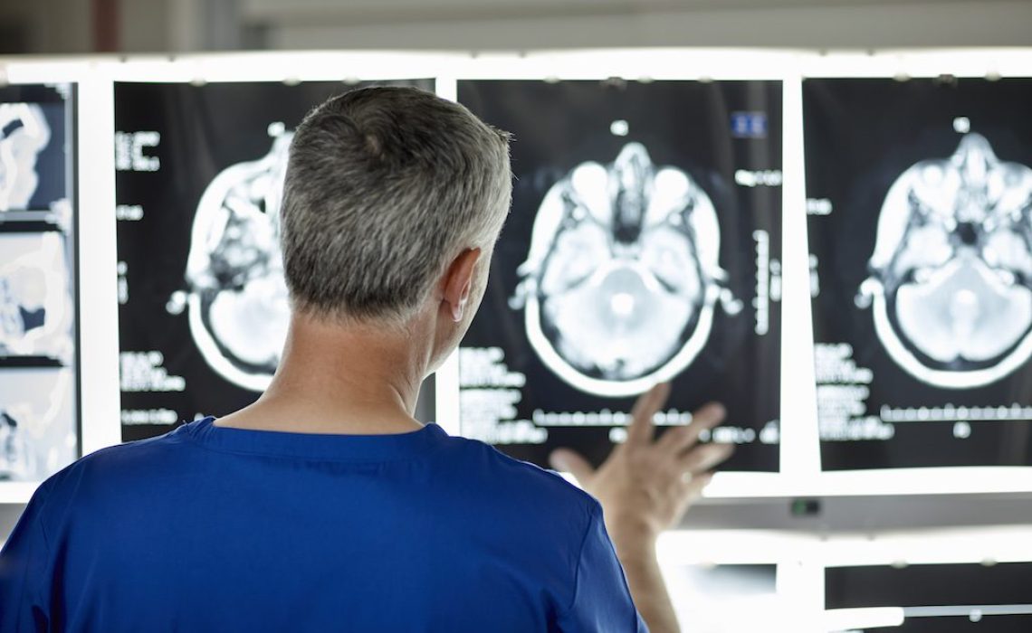 Radiologist looking at brain scans