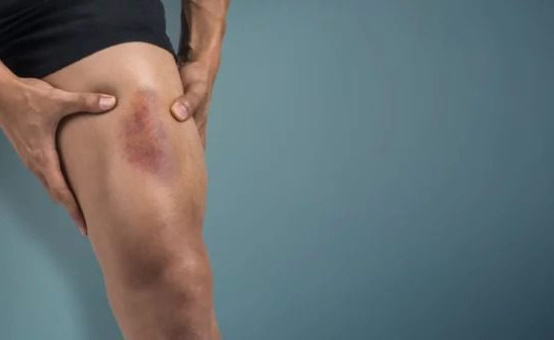 screenshot-from-2023-03-21-17-32-07-560x336